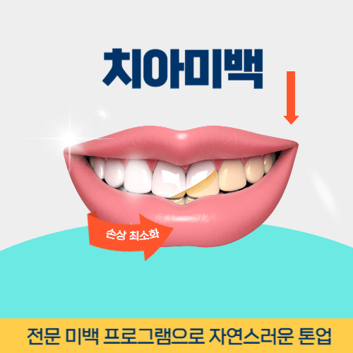 군포치과 군포시 치과 치아미백