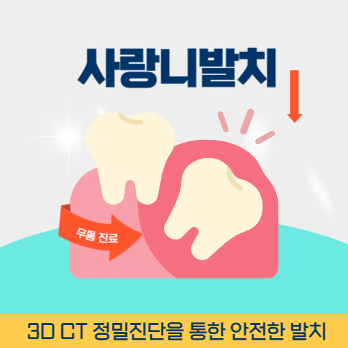 군포치과 군포시 치과 사랑니 발치