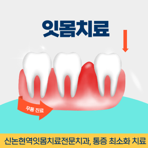 군포치과 군포시 치과 잇몸치료